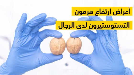 هذه الأعراض تدل على ارتفاع هرمون الذكورة لدى الرجال